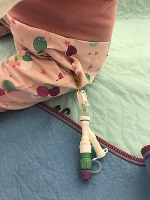 Sondenhose mit Sondenöffnung